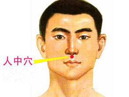 水溝穴→治昏迷、暈厥