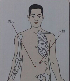 針灸治療便秘哪個穴位？便秘的針灸療法