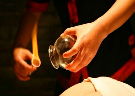 中醫(yī)拔罐時(shí)，哪些身體部位不能拔