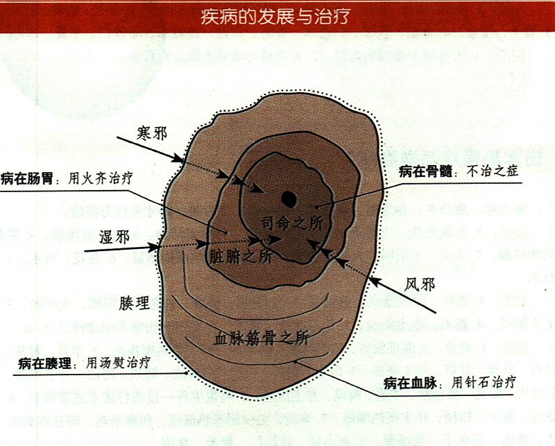 諸氣應(yīng)怎樣治療？