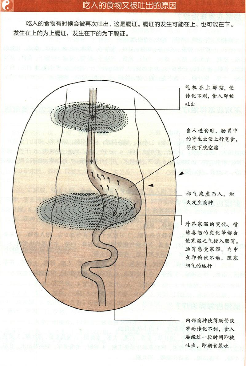 嘔吐應(yīng)怎樣治療？